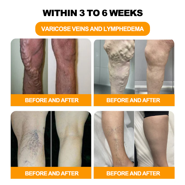 INSIDEEFYโข 30-Herb Slimming & Detox Foot Bath Beads-๐ฆต๐ฉโโ๏ธ(LANA Certification, Lymphatic Association of America)