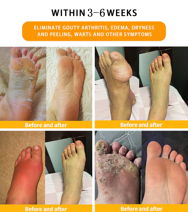 INSIDEEFYโข 30-Herb Slimming & Detox Foot Bath Beads-๐ฆต๐ฉโโ๏ธ(LANA Certification, Lymphatic Association of America)
