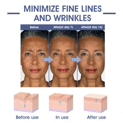 𝐋𝐚𝐬𝐭 𝐃𝐚𝐲 𝐃𝐢𝐬𝐜𝐨𝐮𝐧𝐭: 87% 𝐎𝐅𝐅🌸LOVILDS® 𝐀𝐝𝐯𝐚𝐧𝐜𝐞𝐝 𝐅𝐢𝐫𝐦𝐢𝐧𝐠 & 𝐖𝐫𝐢𝐧𝐤𝐥𝐞-𝐑𝐞𝐝𝐮𝐜𝐢𝐧𝐠 𝐂𝐫𝐞𝐚𝐦: Restore Skin Elasticity