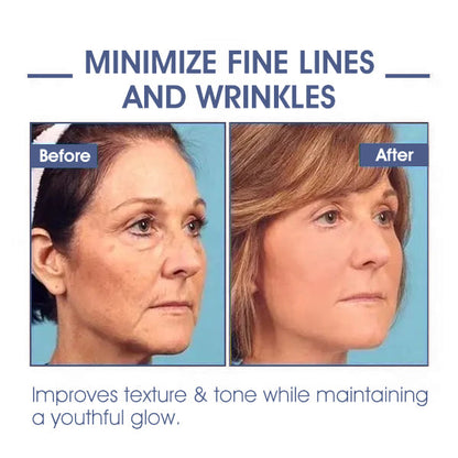 𝐋𝐚𝐬𝐭 𝐃𝐚𝐲 𝐃𝐢𝐬𝐜𝐨𝐮𝐧𝐭: 87% 𝐎𝐅𝐅🌸LOVILDS® 𝐀𝐝𝐯𝐚𝐧𝐜𝐞𝐝 𝐅𝐢𝐫𝐦𝐢𝐧𝐠 & 𝐖𝐫𝐢𝐧𝐤𝐥𝐞-𝐑𝐞𝐝𝐮𝐜𝐢𝐧𝐠 𝐂𝐫𝐞𝐚𝐦: Restore Skin Elasticity