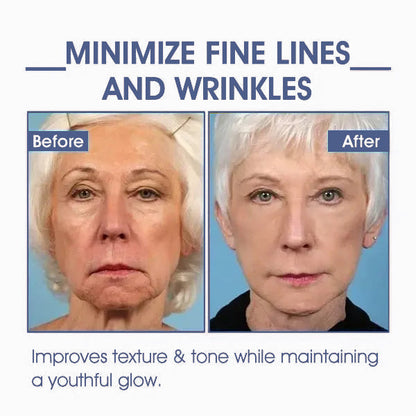 𝐋𝐚𝐬𝐭 𝐃𝐚𝐲 𝐃𝐢𝐬𝐜𝐨𝐮𝐧𝐭: 87% 𝐎𝐅𝐅🌸LOVILDS® 𝐀𝐝𝐯𝐚𝐧𝐜𝐞𝐝 𝐅𝐢𝐫𝐦𝐢𝐧𝐠 & 𝐖𝐫𝐢𝐧𝐤𝐥𝐞-𝐑𝐞𝐝𝐮𝐜𝐢𝐧𝐠 𝐂𝐫𝐞𝐚𝐦: Restore Skin Elasticity