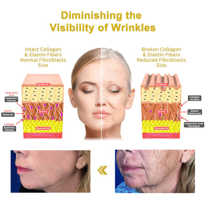 𝐋𝐚𝐬𝐭 𝐃𝐚𝐲 𝐃𝐢𝐬𝐜𝐨𝐮𝐧𝐭: 87% 𝐎𝐅𝐅🌸LOVILDS® 𝐀𝐝𝐯𝐚𝐧𝐜𝐞𝐝 𝐅𝐢𝐫𝐦𝐢𝐧𝐠 & 𝐖𝐫𝐢𝐧𝐤𝐥𝐞-𝐑𝐞𝐝𝐮𝐜𝐢𝐧𝐠 𝐂𝐫𝐞𝐚𝐦: Restore Skin Elasticity