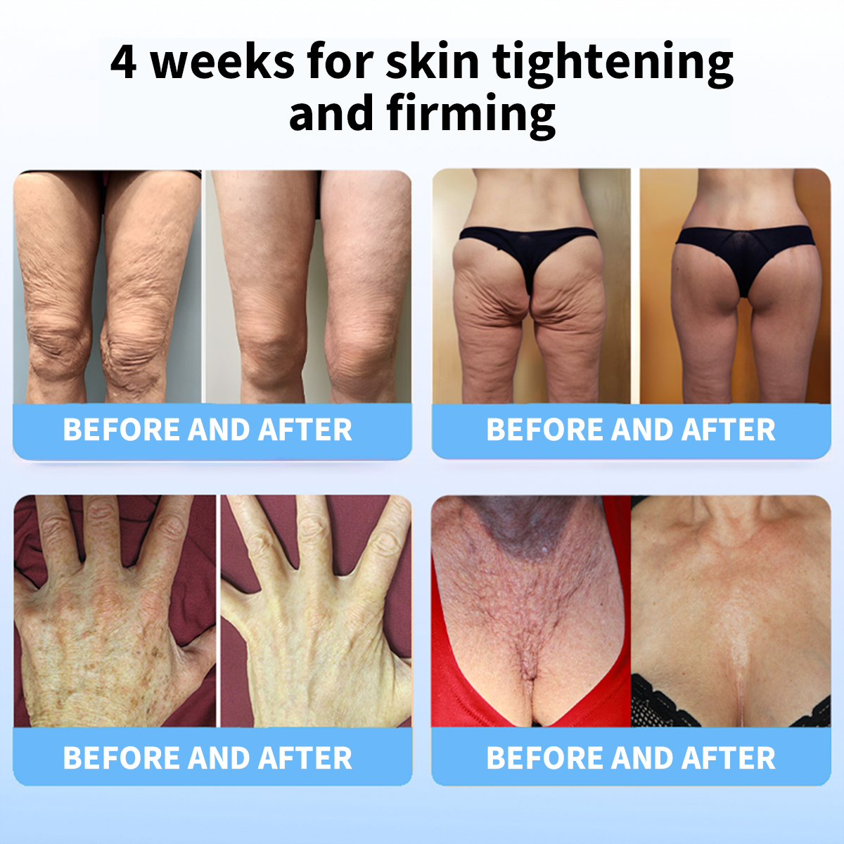 𝐋𝐚𝐬𝐭 𝐃𝐚𝐲 𝐃𝐢𝐬𝐜𝐨𝐮𝐧𝐭: 87% 𝐎𝐅𝐅🌸LOVILDS® 𝐀𝐝𝐯𝐚𝐧𝐜𝐞𝐝 𝐅𝐢𝐫𝐦𝐢𝐧𝐠 & 𝐖𝐫𝐢𝐧𝐤𝐥𝐞-𝐑𝐞𝐝𝐮𝐜𝐢𝐧𝐠 𝐂𝐫𝐞𝐚𝐦: Restore Skin Elasticity