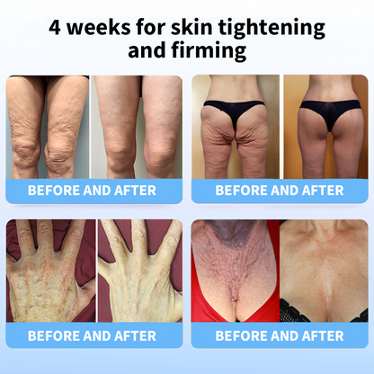 𝐋𝐚𝐬𝐭 𝐃𝐚𝐲 𝐃𝐢𝐬𝐜𝐨𝐮𝐧𝐭: 87% 𝐎𝐅𝐅🌸LOVILDS® 𝐀𝐝𝐯𝐚𝐧𝐜𝐞𝐝 𝐅𝐢𝐫𝐦𝐢𝐧𝐠 & 𝐖𝐫𝐢𝐧𝐤𝐥𝐞-𝐑𝐞𝐝𝐮𝐜𝐢𝐧𝐠 𝐂𝐫𝐞𝐚𝐦: Restore Skin Elasticity