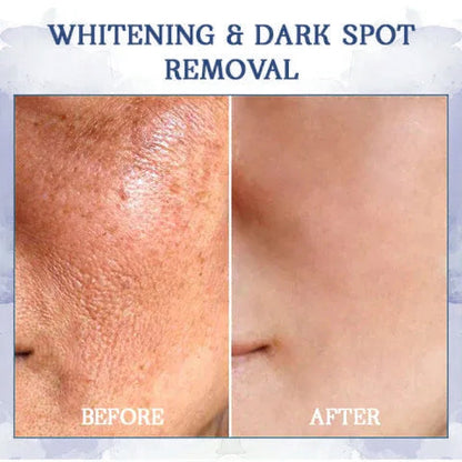 𝐋𝐚𝐬𝐭 𝐃𝐚𝐲 𝐃𝐢𝐬𝐜𝐨𝐮𝐧𝐭: 87% 𝐎𝐅𝐅🌸LOVILDS® 𝐀𝐝𝐯𝐚𝐧𝐜𝐞𝐝 𝐅𝐢𝐫𝐦𝐢𝐧𝐠 & 𝐖𝐫𝐢𝐧𝐤𝐥𝐞-𝐑𝐞𝐝𝐮𝐜𝐢𝐧𝐠 𝐂𝐫𝐞𝐚𝐦: Restore Skin Elasticity