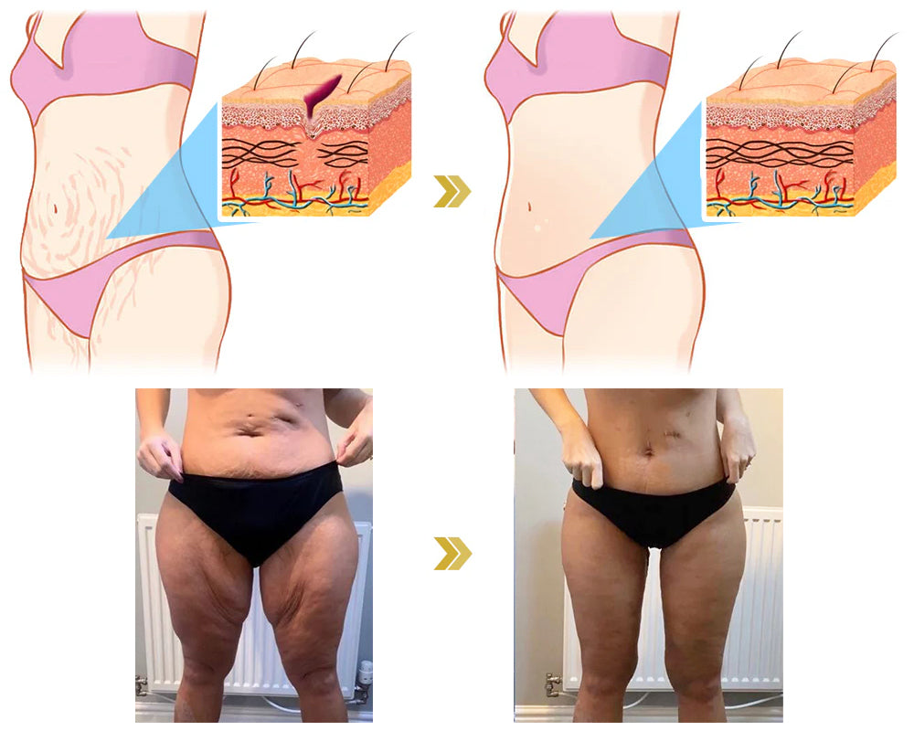 𝐋𝐚𝐬𝐭 𝐃𝐚𝐲 𝐃𝐢𝐬𝐜𝐨𝐮𝐧𝐭: 87% 𝐎𝐅𝐅🌸LOVILDS® 𝐀𝐝𝐯𝐚𝐧𝐜𝐞𝐝 𝐅𝐢𝐫𝐦𝐢𝐧𝐠 & 𝐖𝐫𝐢𝐧𝐤𝐥𝐞-𝐑𝐞𝐝𝐮𝐜𝐢𝐧𝐠 𝐂𝐫𝐞𝐚𝐦: Restore Skin Elasticity