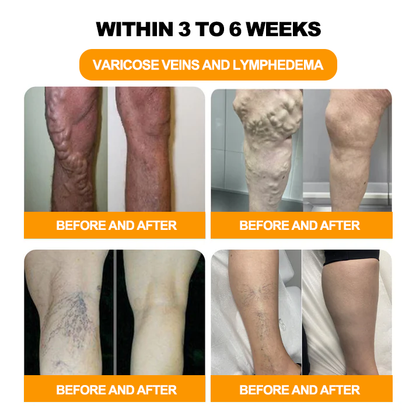 INSIDEEFY™ 30-Herb Slimming & Detox Foot Bath Beads-🦵👩‍⚕️(LANA Certification, Lymphatic Association of America)