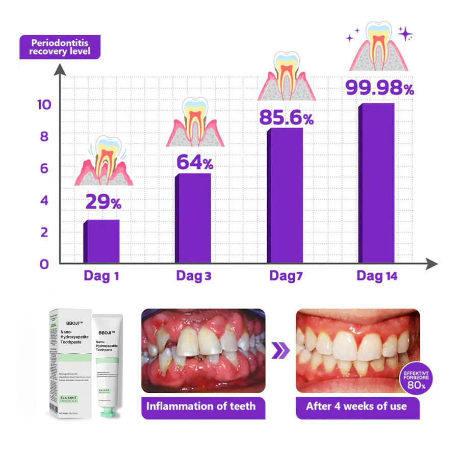 BBOJI™ Fluoride-Free Nano-Hydroxyapatite Toothpaste🦷(✨ADA recommended)(⏳ FINAL DAY! Buy 1 Get 1 FREE! ⏳)