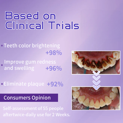 BBOJI™ Fluoride-Free Nano-Hydroxyapatite Toothpaste🦷(✨ADA recommended)(⏳ FINAL DAY! Buy 1 Get 1 FREE! ⏳)